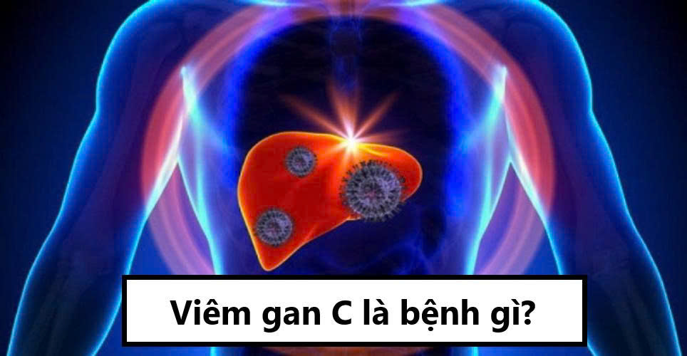 Viêm gan C là gì?