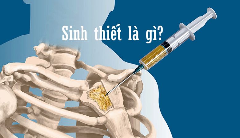 Sinh thiết là gì?