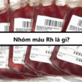 Nhóm máu Rh là gì?
