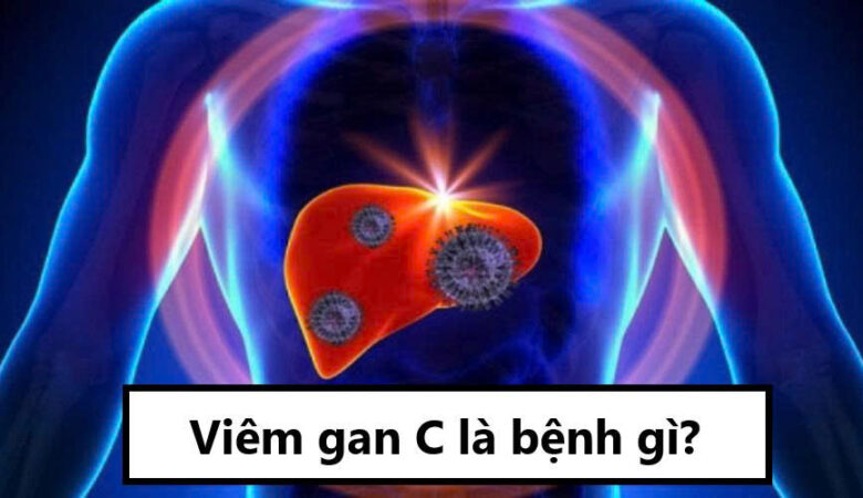 Viêm gan C là gì?